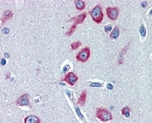 PCK1 Antibody