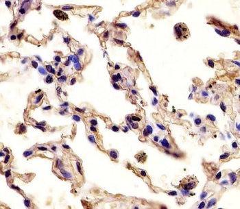 IHC testing of FFPE human lung tissue with MMP12 antibody. HIER: steam section in pH6 citrate buffer