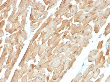 IHC staining of FFPE human cardiac muscle with Dystrophin antibody (clone DMD/3677). HIER: boil tiss