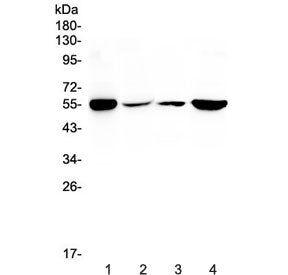 Western blot testing of human 1) HeLa, 2) HepG2, 3) A549 and 4) 22RV1 cell lysate with Glutathione R