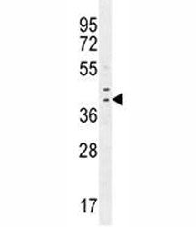IRF1 antibody western blot analysis in human MDA-MB-231 cell lysate. Expected molecular weight: ~37 