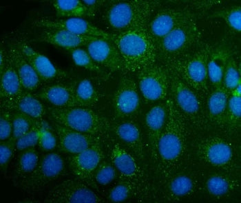 ABAT Antibody / 4-aminobutyrate aminotransferase