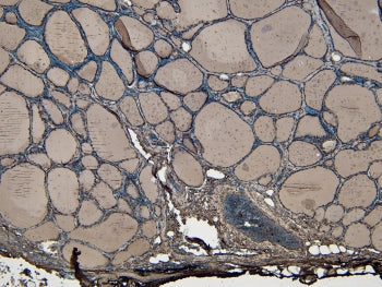 IHC staining of FFPE human thyroid gland tissue with ENPP1 antibody at 4ug/ml. HIER: steamed with pH