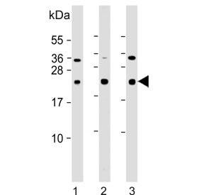 Western blot testing of human 1) A549, 2) Ramos and 3) U-87 MG cell lysate with CD81 antibody. Predi