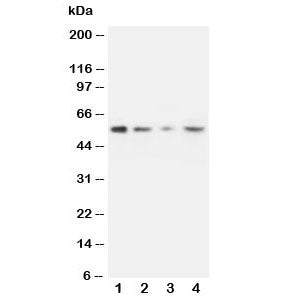 Western blot testing of MMP10 antibody and Lane 1: recombinant human protein 10ng; 2: 5ng; 3: 2.5ng;