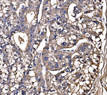LSR Antibody / Lipolysis-stimulated lipoprotein receptor