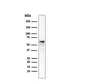Western blot testing of human MCF7 cell lysate with AKT1 antibody. Predicted molecular weight ~56 kD