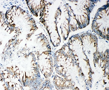 MMP14 Antibody