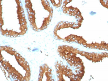 IHC staining of FFPE human tonsil tissue with recombinant LAMP-3 antibody (clone LAMP3/8678R). HIER: