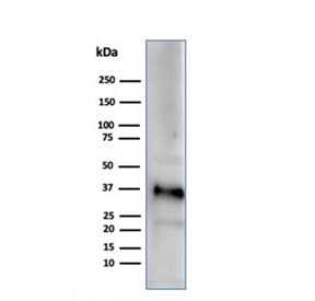 Western blot testing of human testis tissue lysate using Apolipoprotein J antibody (clone CLU/4729). Predicted molecular weight: 75-80 kDa (heterodimer precursor), 36-39 kDa (alpha subunit), 34-36 kDa (beta subunit).