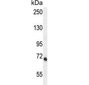 Western blot testing of human MDA-MB-435 cell lysate with VPS52 antibody. Predicted molecular weight