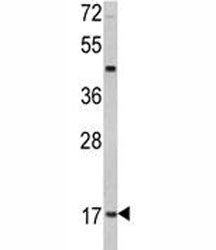 Leptin Antibody (LEP)