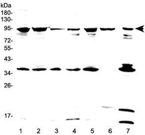 Western blot testing of human 1) HeLa, 2) 293T, 3) SKOV3, 4) A549, 5) MCF7, 6) placenta and 7) PANC-