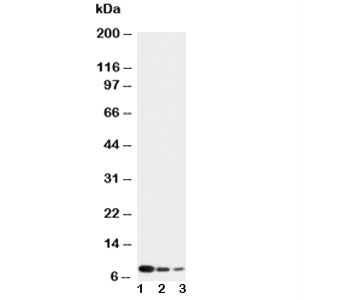 Western blot testing of CXCL4 antibody and Lane 1: recombinant human protein 10ng; 2: 5ng; 3: 2.5ng