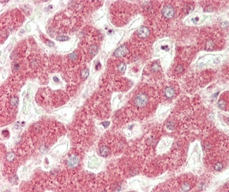 IHC testing of FFPE human liver tissue with NADH-ubiquinone oxidoreductase chain 5 antibody. HIER: s