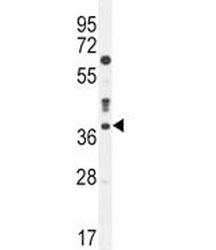 Caspase-3 Antibody, 0.4ml
