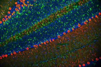 Immunofluorescent staining of FFPE rat cerebellum tissue with PKC gamma antibody (red), GFAP antibod