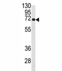 Western blot analysis of CDC25B antibody and Ramos lysate. Expected/observed molecular weight: 61~67