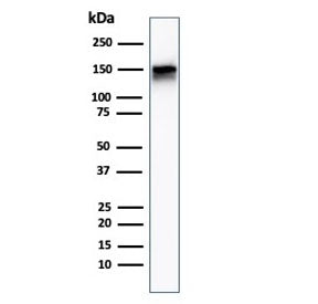 Western blot testing of human A431 cell lysate with EGF Receptor antibody (clone F4). Expected molec