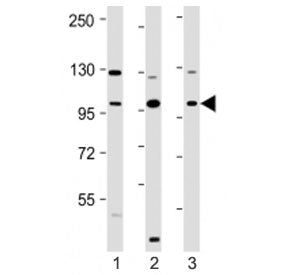 Western blot testing of VAV2 antibody at 1:2000: Lane 1) human HeLa, 2) MCF7 and 3) SH-SY5Y cell lys