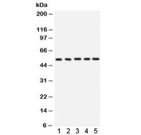 Western blot testing of 1) rat testis, 2) rat pancreas, 3) rat skeletal muscle, 4) mouse kidney and 