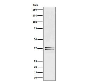 Western blot testing of human Jurkat cell lysate with LAT antibody. Expected molecular weight: 36-38