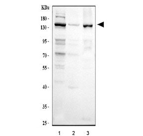 Western blot testing of human 1) HeLa, 2) A431 and 3) SiHa cell lysate with CSB antibody at 0.5ug/ml. Predicted/observed molecular weight: ~168 kDa.