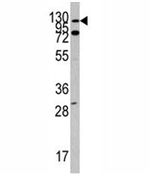 ABL1 Antibody