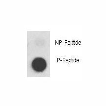 Dot blot analysis of phospho-MET antibody. 50ng of phos-peptide or nonphos-peptide per dot were spot