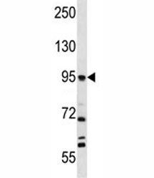 FAP antibody western blot analysis in NCI-H292 lysate. Predicted molecular weight 88~95 kDa (monomer