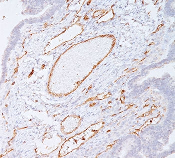 CD31 Antibody / PECAM-1