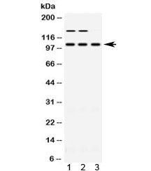 ACTN3 Antibody