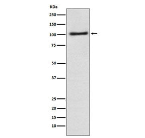 Western blot testing of human A431 cell lysate with AP2A1 antibody. Predicted molecular weight ~108 