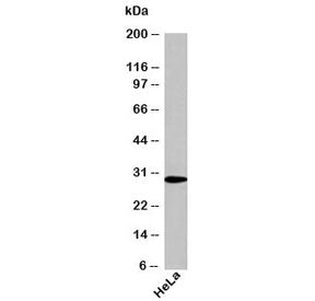 Western blot testing of human samples using NQO1 antibody at 1ug/ml. Predicted molecular weight ~30k