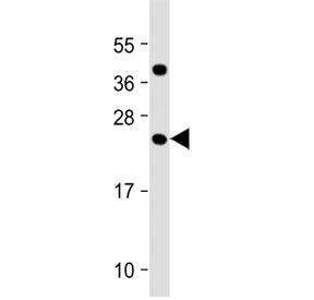 Western blot testing of human testis tissue lysate with FAM3A antibody at 1:2000. Predicted molecula