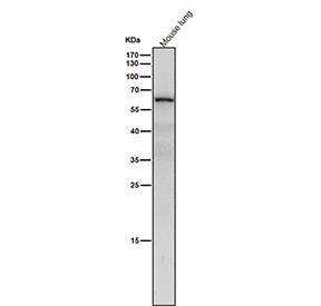 Mouse lung tissue lysate western blot tested with the NR2C2 antibody at 1:4000 dilution for 1 hour a