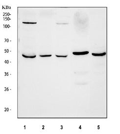 Western blot testing of 1) human HepG2, 2) human U-2 OS, 3) human Caco-2, 4) rat lung and 5) mouse l