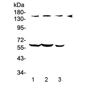 Western blot testing of human 1) COLO-320, 2) HepG2 and 3) A549 lysate with KCNH1 antibody at 0.5ug/