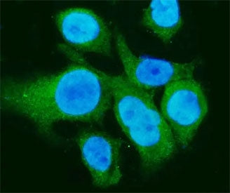 Immunofluorescent staining of FFPE human Caco-2 cells with Carbonic Anhydrase I antibody (green) and