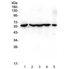 Western blot testing of human 1) HeLa, 2) MCF7, 3) COLO-320, 4) HepG2 and 5) HT-1080 cell lysate wit