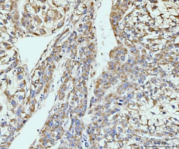 GIT1 Antibody / p95-APP1