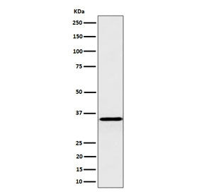 Western blot testing of human HepG2 cell lysate with Pyrophosphatase 1 antibody. Predicted molecular