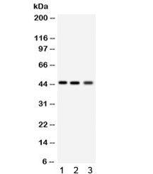 RAGE Antibody