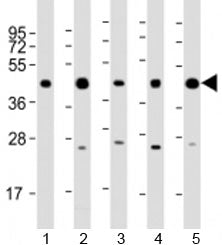 Western blot testing of human 1) 293T/17, 2) A431, 3) HeLa, 4) Jurkat and 5) K562 cell lysate with P