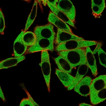 Immunofluorescent staining of human HeLa cells using RPS6KA5 antibody (green, clone PCRP-RPS6KA5-1A8