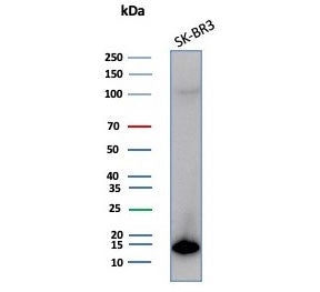 Western blot testing of human SK-BR-3 cell lysate with S100P antibody (clone S100P/7373). Predicted 