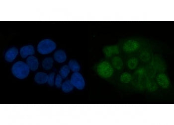 Immunofluorescent staining of FFPE human A431 cells with ATR antibody (green) and DAPI nuclear stain