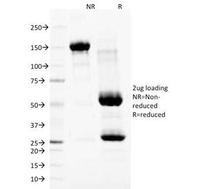 Nuclear Membrane Marker Antibody