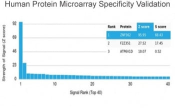 Analysis of HuProt(TM) microarray containing more than 19,000 full-length human proteins using ZNF56