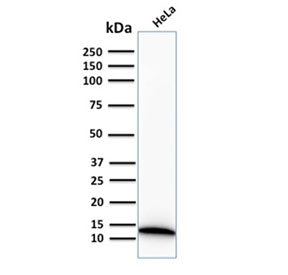 Western blot testing of human HeLa cell lysate with recombinant S100A4 antibody. Predicted molecular
